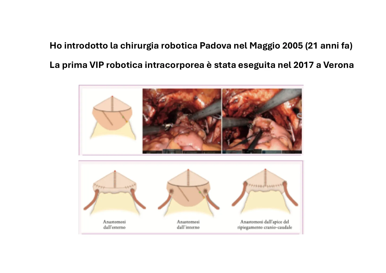 Page 14: Robotic surgery in Padua since 2005 and the first robotic VIP